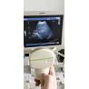 Buy cheap Toshiba PVM-375AT Convex Array Transducer Ultrasound Probe 3.0MHz. - 6.0MHz from wholesalers