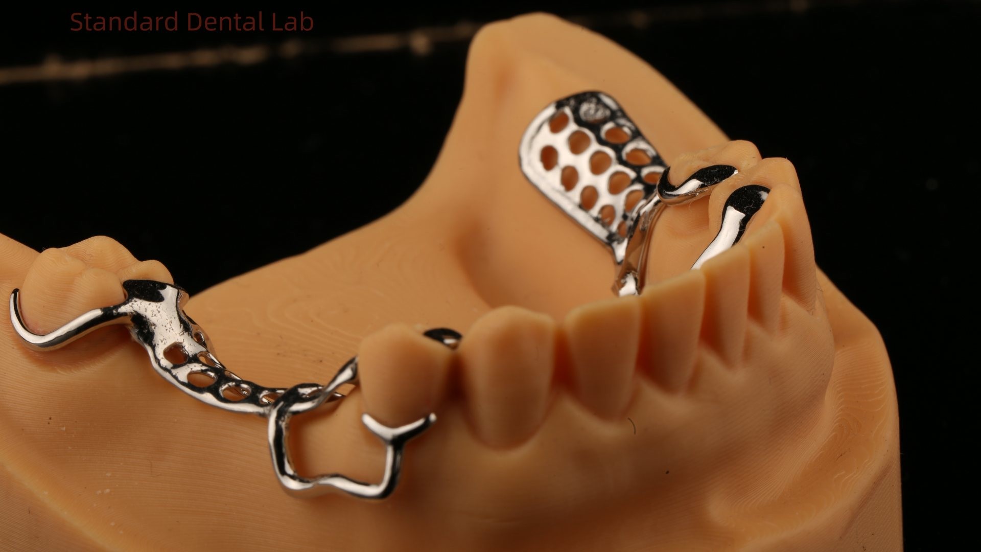 Upper Cast Metal Framework Partial Dentures Strong Lightweight And Durable