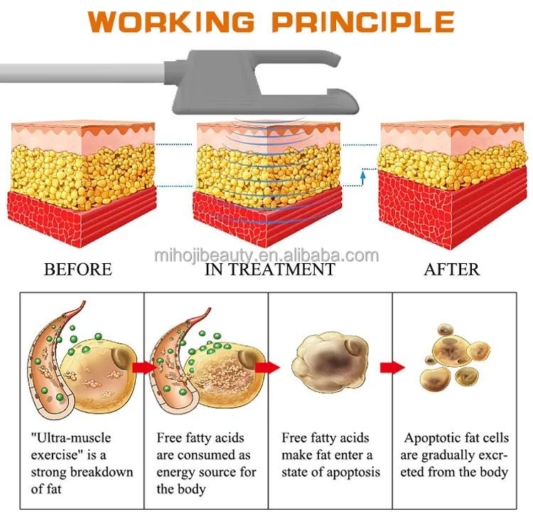 High Frequency Hiemt Sculpting Body Machine For Lifting Buttock And Reducing Cellulite