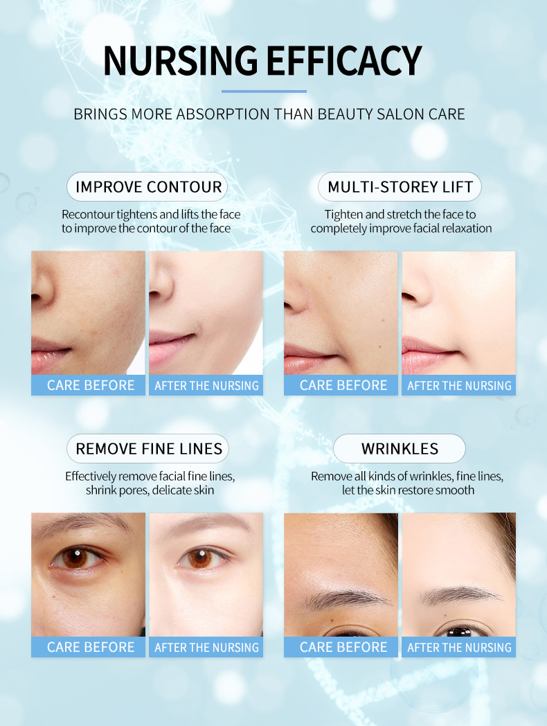2 in 1 HIFU 7d hifu face lift machine high intensity focused ultrasound hifu face lift machine