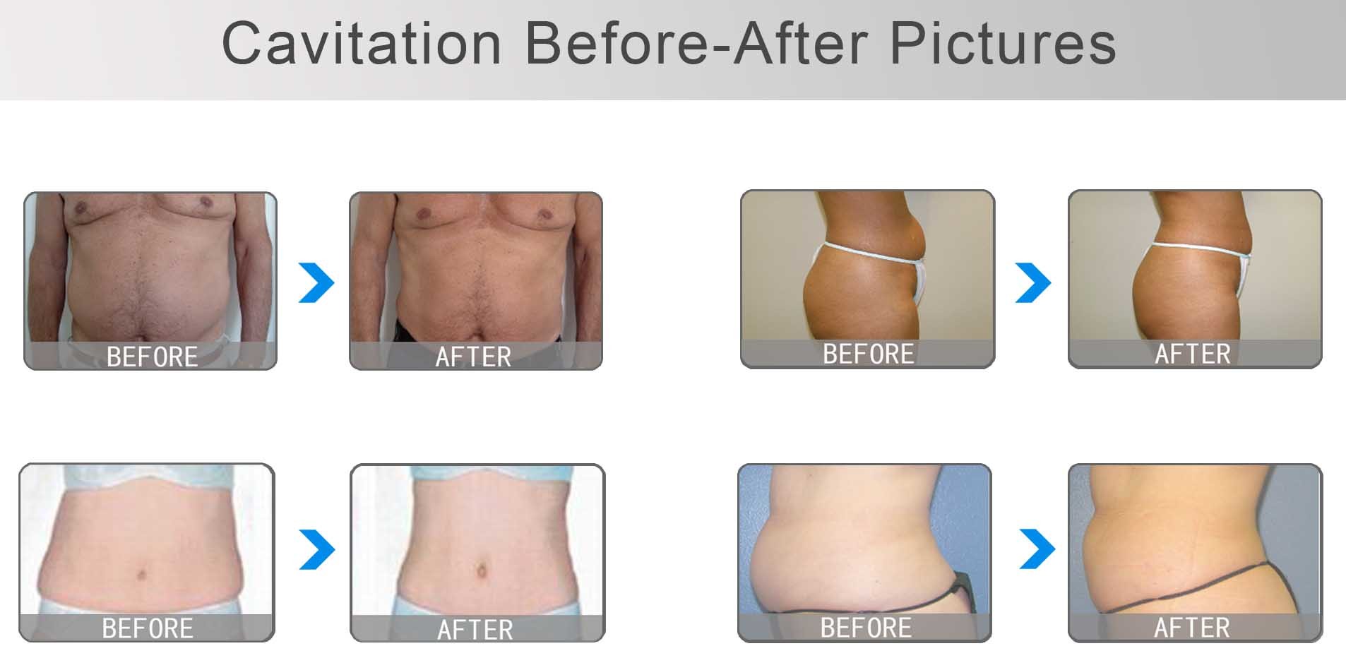 Beauty Equipment RF Cavitation body Slimming Machine vacuum weight loss machine
