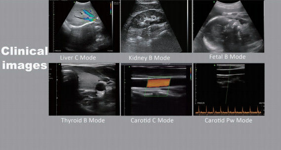 Handheld USB Convex Wireless Ultrasound Probe Medical Doppler 3.5-5 Mhz For Adroid