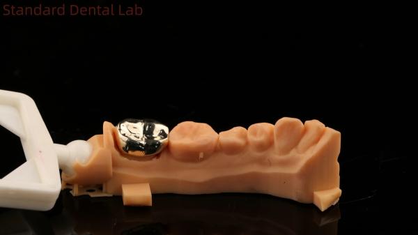 High Nobel Yellow Gold Crown Tooth Professional Ni Be Free ISO And FDA Approved