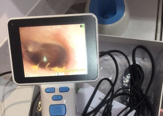 Handheld Digital Video Otoscope With Diameter of lense 0.5cm Mini USB Connection 8 Hours Continouns Working 1