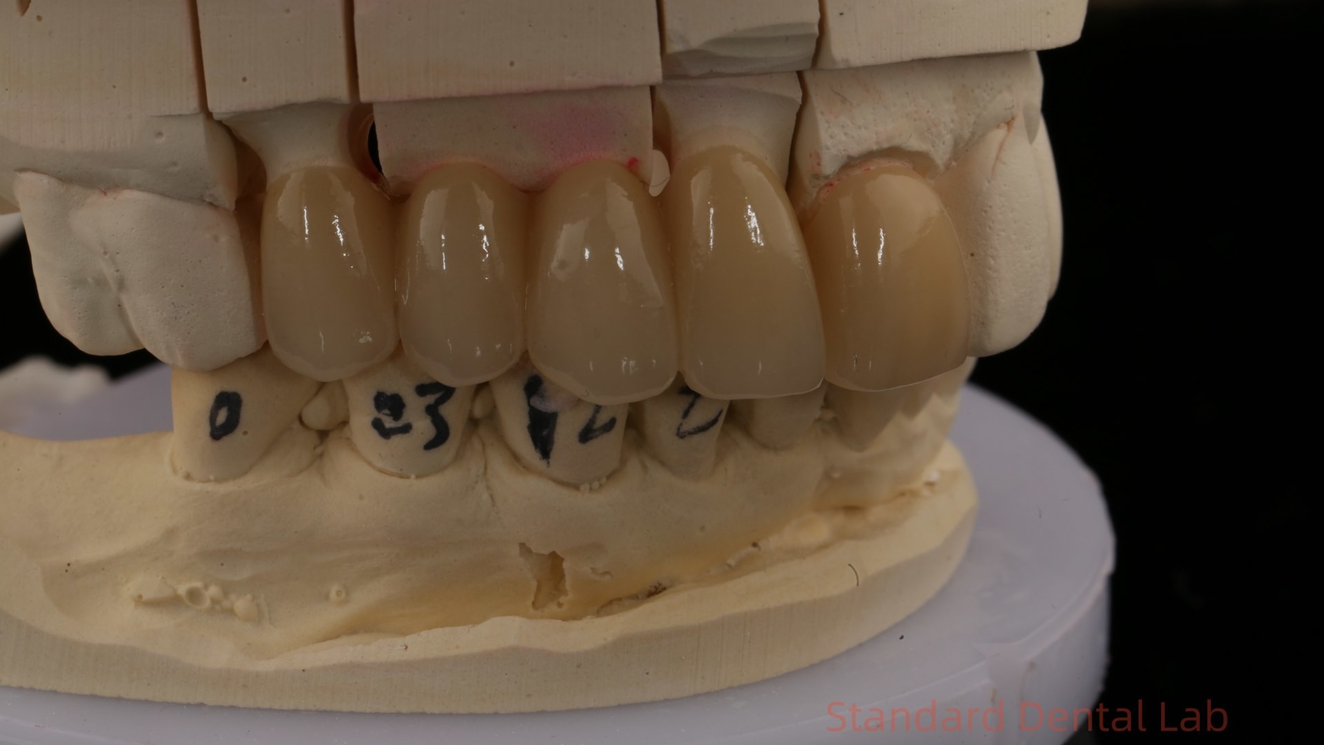 Noritake Porcelian Full Contour Zirconia Crown High Aesthetic Natural Customized Zirconia Dental Bridge