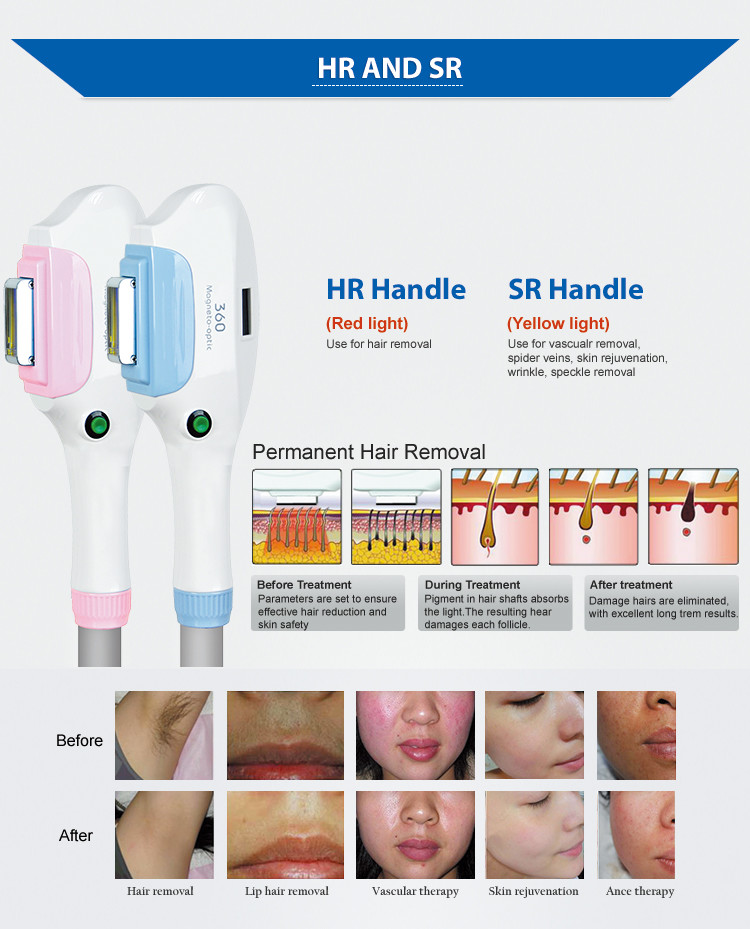 OEM Depilation Laser Shr Ipl Opt Machine E Light Laser Hair Removal Machine