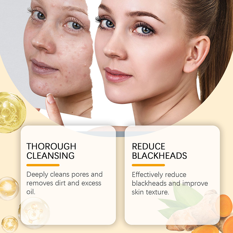 OEM Private Label Kojic Acid Clean and Clear Skin Brightening Foaming Face Wash Turmeric Foam Cleanser for Dark Spots Acne