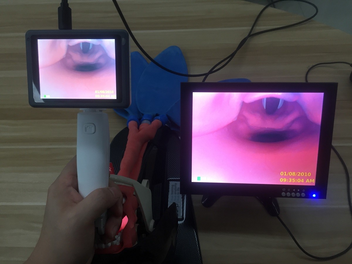 Cheapest video laryngoscope with blades, laryngoscope set for human