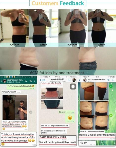 2018 spa use hot selling best effective body shaping beauty device zeltiq