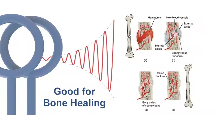 Pulsed Electromagnetic Field Reduce Inflammation Physio Magneto Pemf Magnetic Therapy Device Horse Human