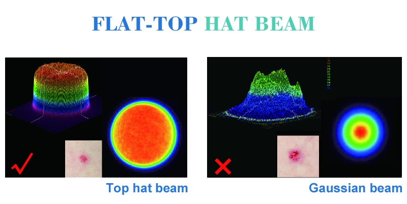 Produced high quality picosecond machine 1064nm laser removal tattoo for beauty equipment