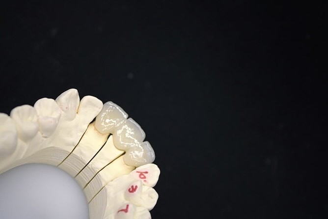 Precise Zirconia Crown Bridge Comfortable Fit / Esthetics 3-4 Days Quick Turnaround Time