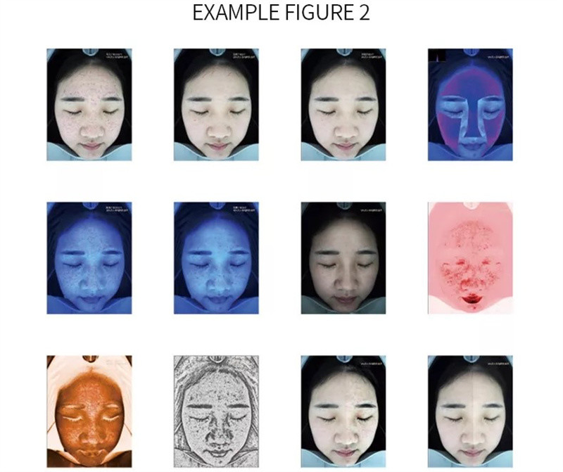 Portable Ai 20 Million Facial Scanner Skin Analyzer 3d Uv Magic Mirror