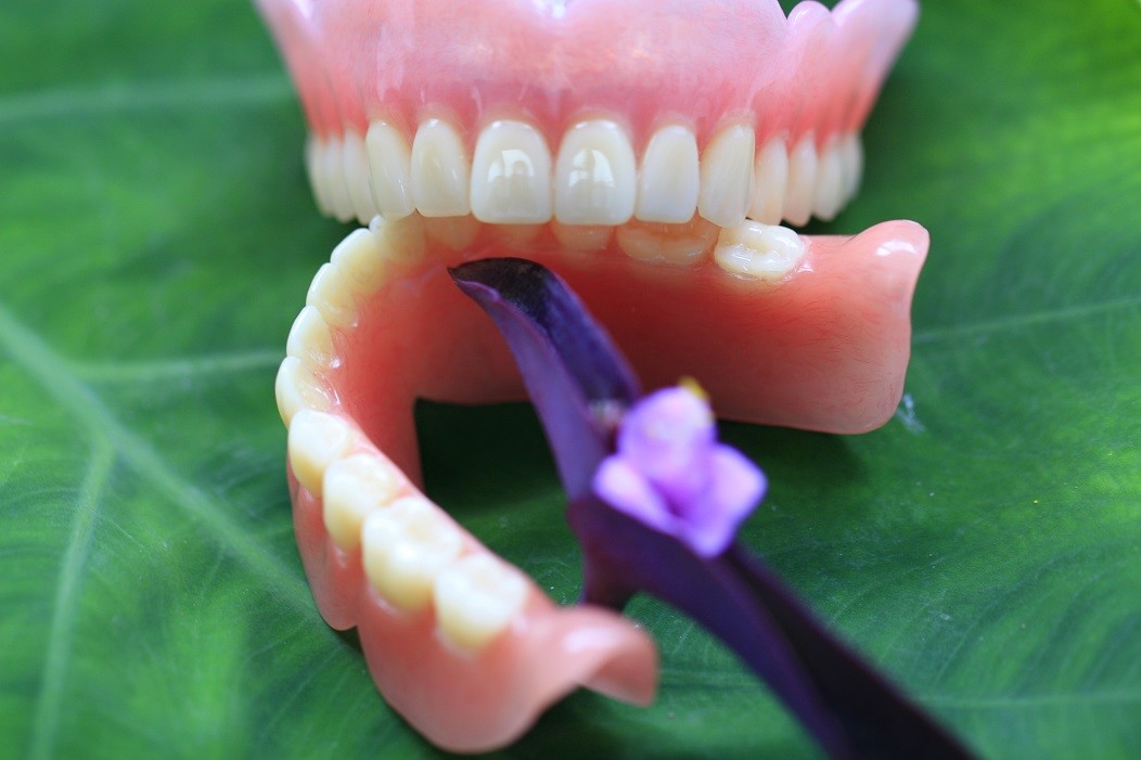 Hot Cured Full Arch Removable Acrylic Full Denture