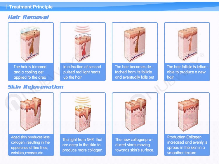 2000W high energy IPL/SHR hair removal skin rejuvenation machine 