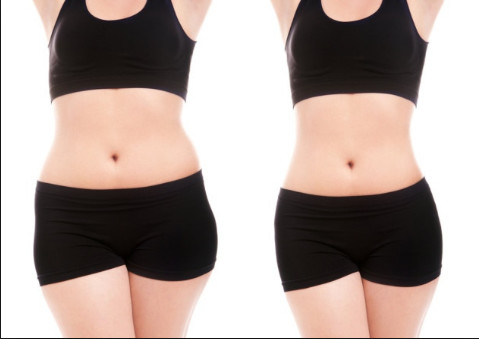 Cryolipolysis slimming equipment Europe popular 4 handpieces cryomed cryolipolysis rf slimming machine