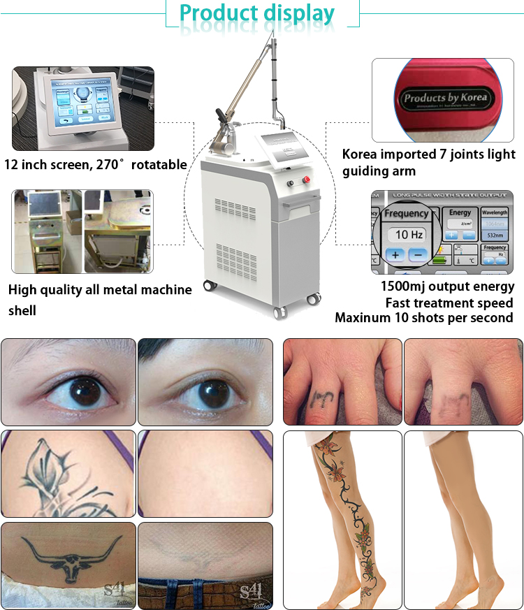 Professional 1064nm&532nm Nd yag laser tattoo removal machine price / Q switch yag laser machine