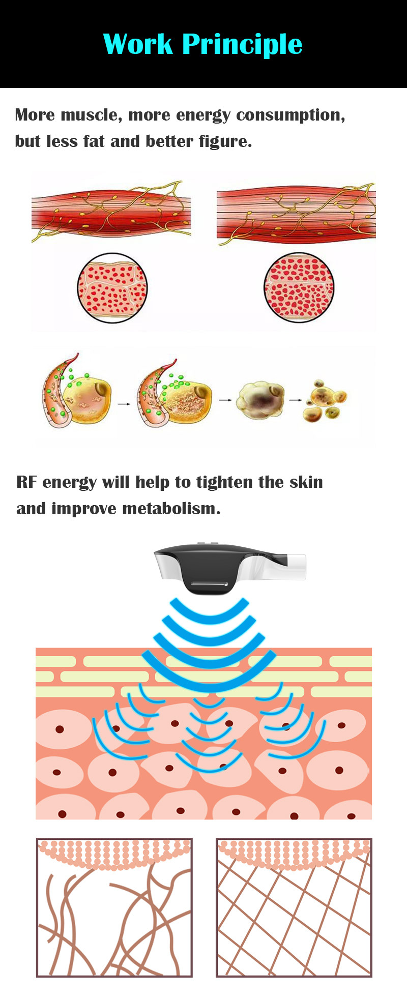 Body Sculpting Cryolipolysis Fat Freezing Machine
