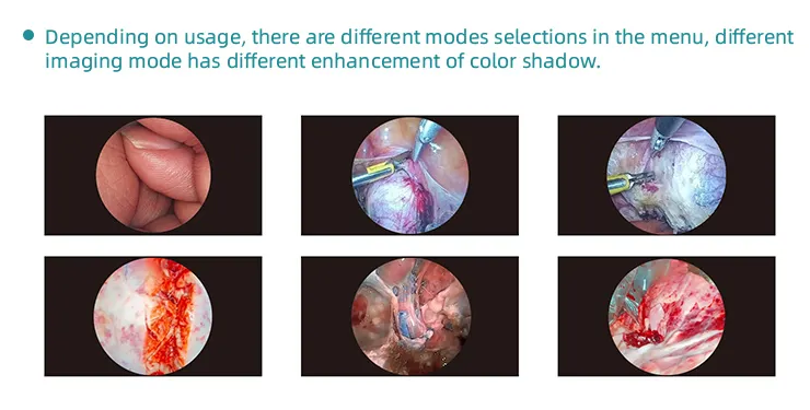 Endoscopy Camera Medical 4 Picture Devide Video Camera For ENT