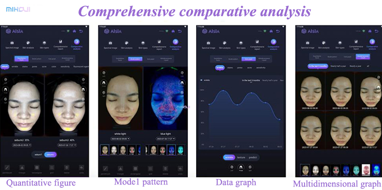 Black/ White Skin Test Analyzer Korean Skin Analyzer Facial Analyzer for Face Target Area