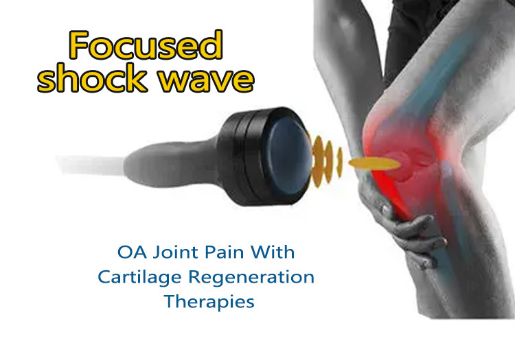 Shockwave Therapy Device ED Shockwave Erectile Dysfunction Focused Shockwave Machine