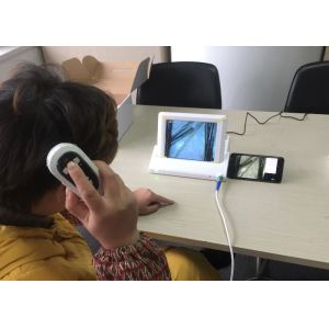 Digital Handheld Video Dermatoscope with 8 Inch Screen 1,4,9 Pictures Displaying