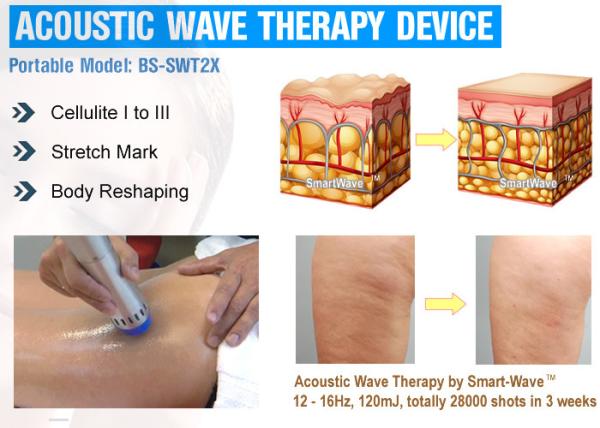 Body Beauty machine acoustic wave therapy machine for body slimming cellulite