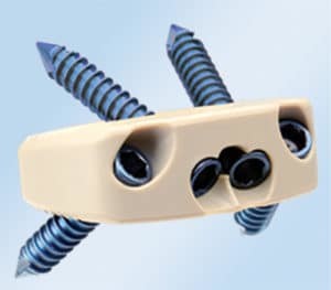 Orthopedic Peek Cage Cervical , Lumbar Cage Interbody Fusion Device Burlywood Color
