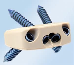 Orthopedic Peek Cage Cervical , Lumbar Cage Interbody Fusion Device Burlywood