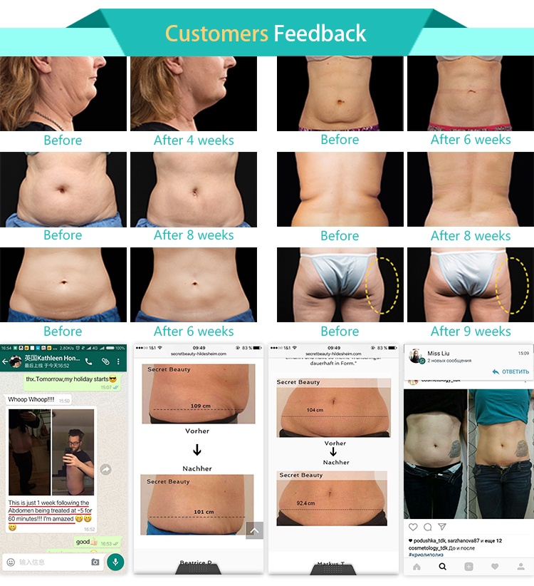 2018 hottest CE approved cryolipolysis fat freezing weight loss clinic beauty machine with cavitaion, RF, cool sculpting