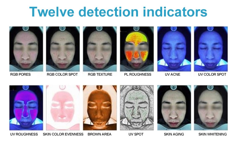 20Megapixel Professional Skin Analyzer 10.6Kg GW for Doctor Cosmetics