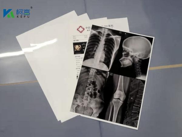 13X17'' White 180 Microns PET X Ray Film Sheets Transparency Film For Inkjet
