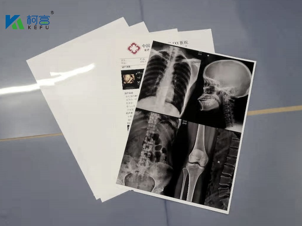 High Resolution PET Base Inkjet X Ray Film for High Printing