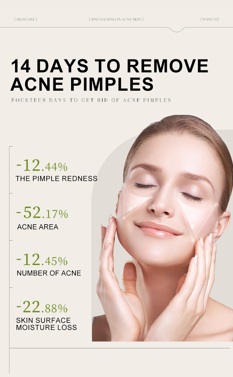 Customized Logo Face Serum 14 Day Quick Acne Solution Essence 10ml