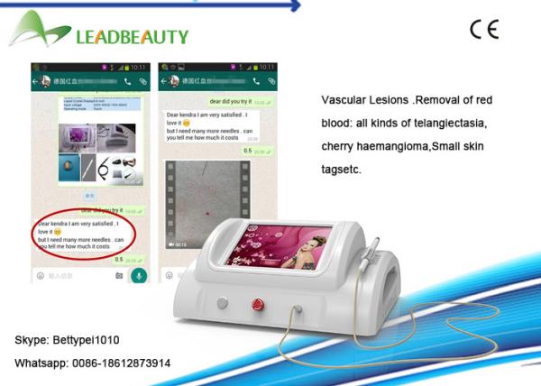 Portable High frequency 30MHZ thermal coagulation vascular spider vein removal