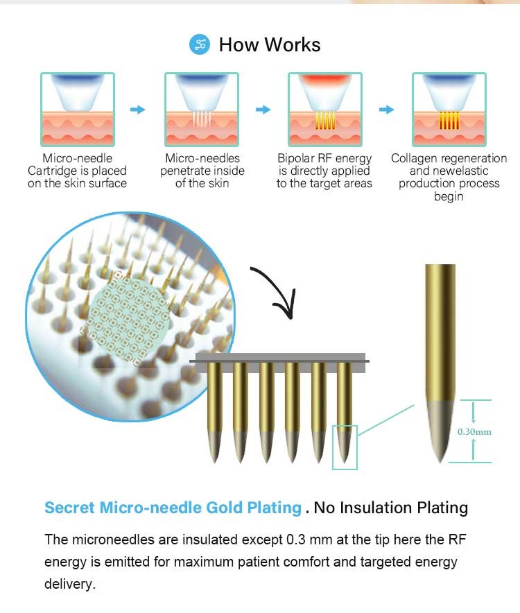 Women Face Lift Micro Needle RF Machine 0.2-3.5mm CE Approved