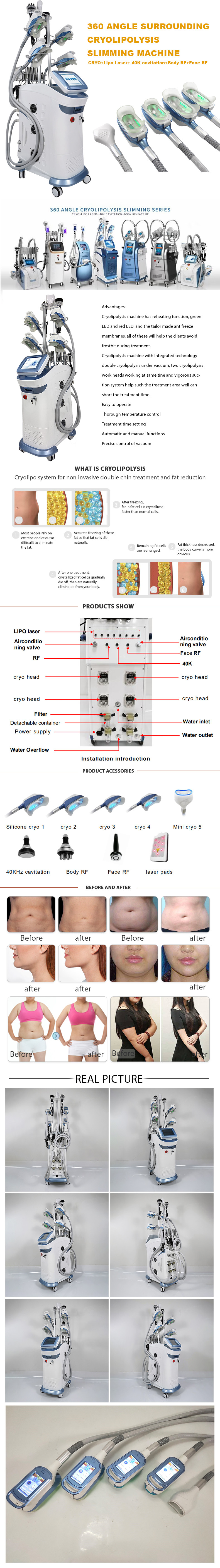 RF Cryolipolysis Fat Freezing Machine 800W , Multifunctional Fat Loss Machine