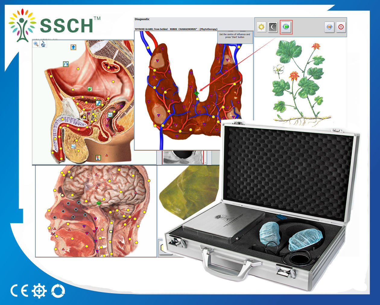 Healthcare Composition Metatron NLS 4025 Body Health Analyzer