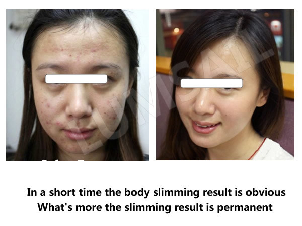 LED Facial Light Therapy Devices / Rejuvenating Skin Light Therapy Unit For Beauty Salon