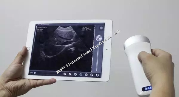 Ipad connecting Wireless Convex Probe Ultrasound Scanner with built-in battery