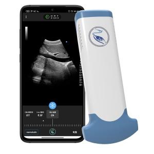 Emergency Medicine MPEG-4 Handheld Ultrasound Scanner For Clinical Diagnostic Use Manufactures