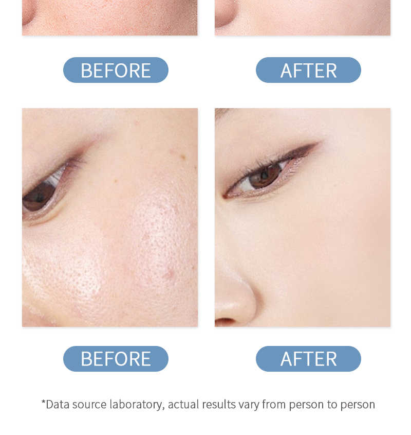 Bodycare Whitening Body Lotion Remove Black Spots And Dark Yellow Skin Care Brightening Hydrating Glutathion