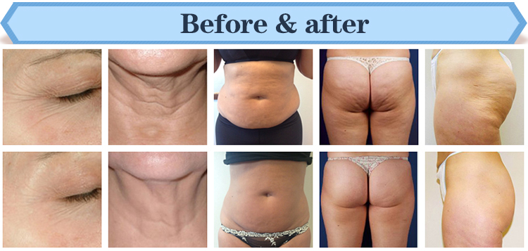 Salon / spa use best slimming machines with distributor prices rf ultrasonic cavitation machine