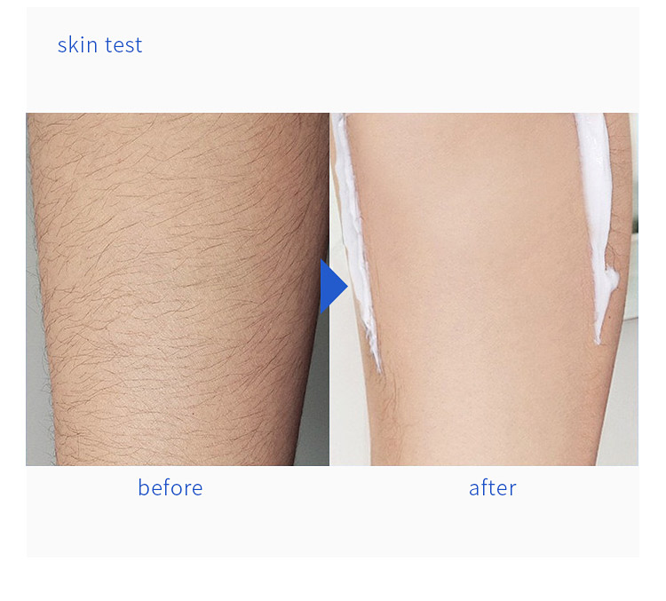 Gentle Body Hair Removal Cream Bodycare Cosmetics Paraben Free