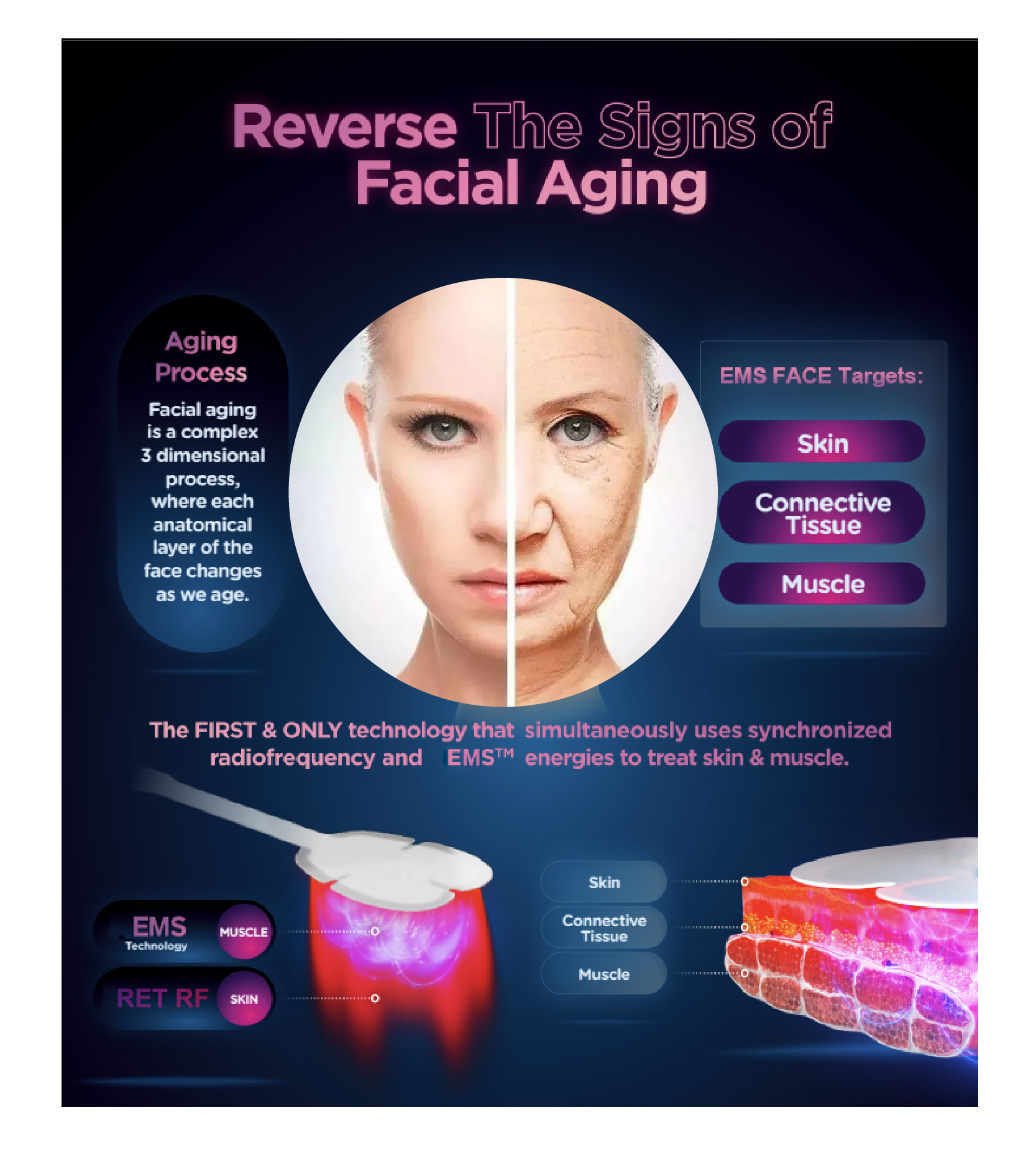 EMS Technology V-face Wrinkle Removal Anti Aging Machine for Portable Facial Firming