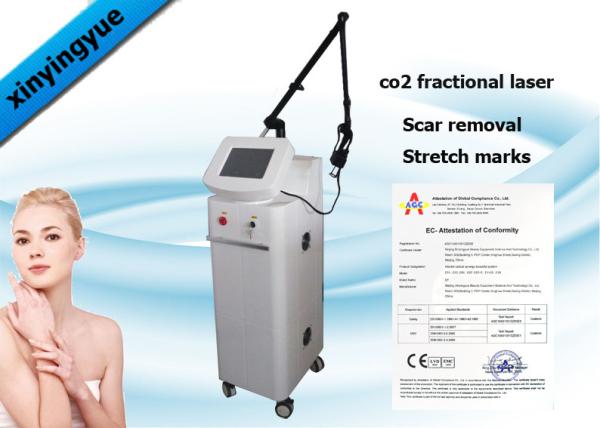 Fractional laser co2 / co2 fractional laser / fractional co2 laser scar removal