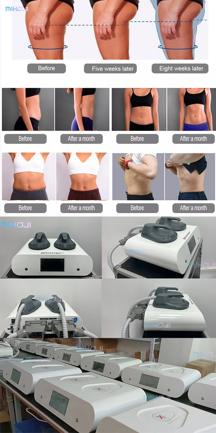 Electrical Muscle Sculpting Machine Emslim Neo RF Operation With 2 Handles