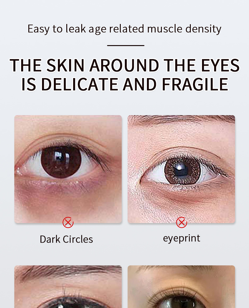 Firming And Moisturizing Reducing Fine Lines Dark Circles And Bag Removal Eye Dark Circles Remove Cream