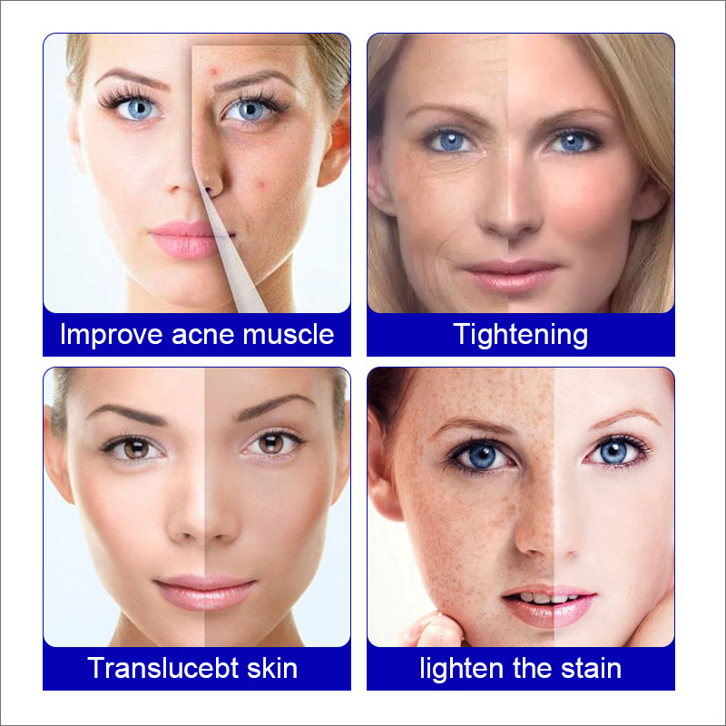 Home Use Rechargeable Wireless 7Color Beauty Light Therapy Led Facial Masks