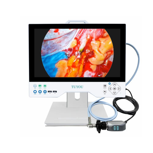 TUYOU 15.6'' UHD All In One Rigid Multi Flexible Endoscopy Camera System For Endoscopy Of Uterus